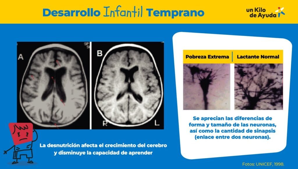 Invertir en la Primera Infancia es prevenir la violencia