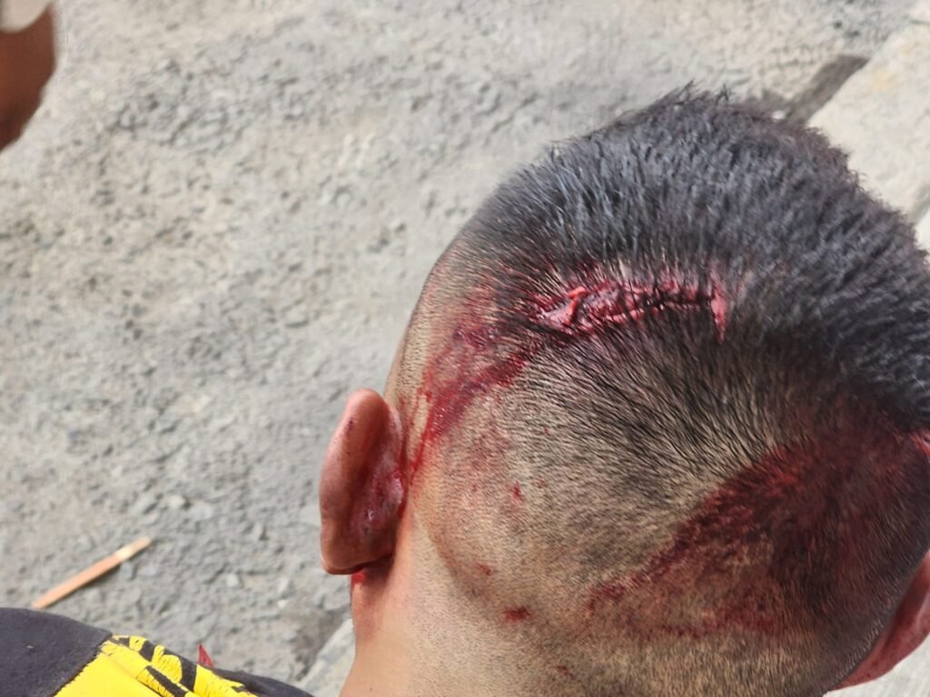 Vecinos golpean a presunto extorsionador en Valle de Anáhuac