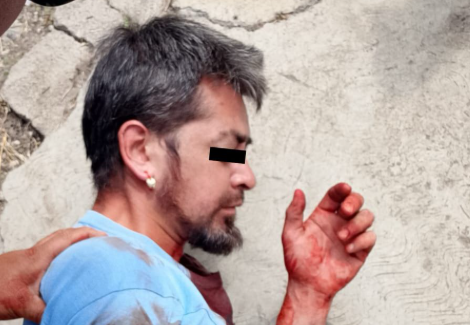 Policía de Ecatepec detiene a sujeto que apuñaló a su familia en Granjas Valle de Guadalupe