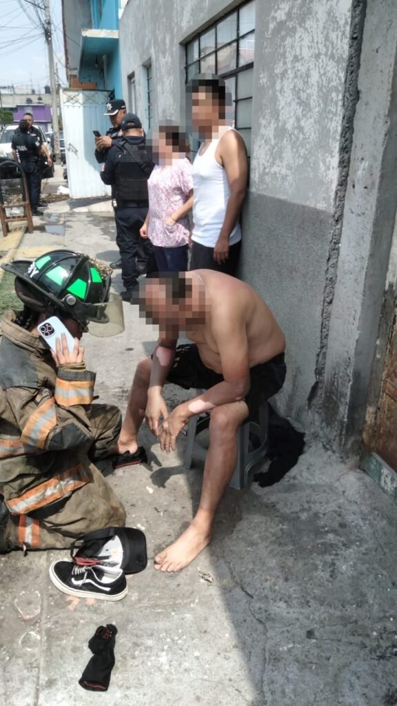 Flamazo en vivienda deja un lesionado en Ecatepec