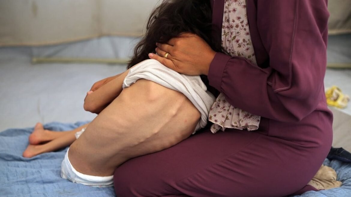 El hambre: silenciosa violencia - Opinión