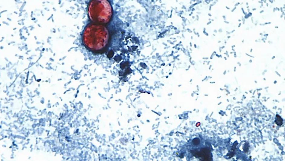 Imagen tomada de microscopio que muestra al parásito que provoca la cyclosporiasis, que ha cobrado ya dos víctimas mortales en Michigan, Estados Unidos.